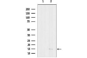 anti-Pro-Platelet Basic Protein (Chemokine (C-X-C Motif) Ligand 7) (PPBP) (Internal Region) antibody