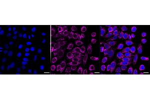 Immunocytochemical staining of HepG2 cells with CLPP antibody (ABIN7798100), 1:1,000).