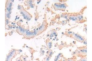 Immunohistochemistry (IHC) image for anti-Membrane Metallo-Endopeptidase (MME) (AA 286-428) antibody (ABIN7438688)