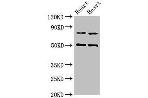 Western Blot Positive WB detected in: Rat heart tissue, Mouse heart tissue All lanes: Acss2 antibody at 4 μg/mL Secondary Goat polyclonal to rabbit IgG at 1/50000 dilution Predicted band size: 79 kDa Observed band size: 79, 50 kDa (ACSS2 Antikörper  (AA 1-701))