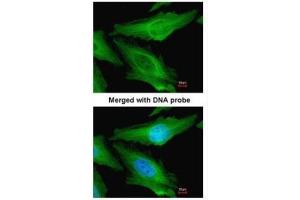 ICC/IF Image Immunofluorescence analysis of paraformaldehyde-fixed HeLa, using TUBB1, antibody at 1:200 dilution. (TUBB1 Antikörper)