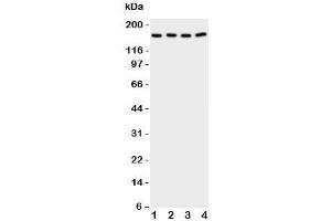 Western blot testing of CPLA2 antibody and Lane 1:  rat testis;  2: (r) brain;  3: human A549;  4: (h) COLO320 cell lysate. (PLA2G4A Antikörper  (C-Term))