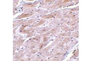 Immunohistochemistry of TRPC3 in mouse heart tissue with this product at 10 μg/ml. (TRPC3 Antikörper  (N-Term))