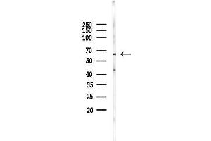 anti-UDP Glucuronosyltransferase 2 Family, Polypeptide B15 (UGT2B15) antibody