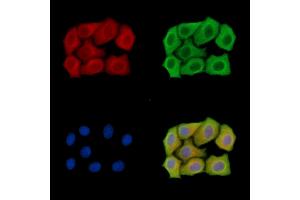 ABIN7095128 and ABIN7099184 staining Hela cells by IF/ICC.
