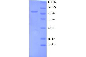Oncostatin M (OSM) (AA 26-220), (full length) protein (GST tag) (Oncostatin M Protein (OSM) (AA 26-220, full length) (GST tag))