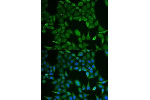 Immunofluorescence analysis of HeLa cell using CLPS antibody. (CLPS Antikörper)