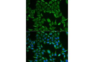 Immunofluorescence analysis of HeLa cell using CLPS antibody. (CLPS Antikörper)