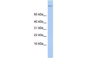 Western Blotting (WB) image for anti-TSC22 Domain Family, Member 1 (TSC22D1) antibody (ABIN2458107) (TSC22D1 Antikörper)
