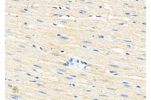 ABIN6260179 and ABIN6279190 at 1/100 staining Rat heart tissue by IHC-P.