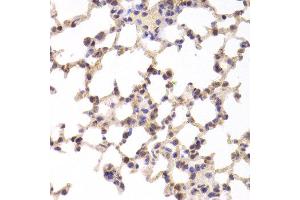 Immunohistochemistry of paraffin-embedded Mouse lung using TSC22D3 antibody at dilution of 1:100 (x400 lens). (TSC22D3 Antikörper)