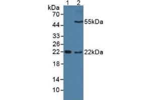 Western blot analysis of (1) Mouse Sp2/0 Cells and (2) Mouse Placenta Tissue. (DC-SIGN/CD209 Antikörper  (AA 70-404))
