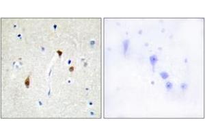 Immunohistochemistry (IHC) image for anti-Hairless (HR) (AA 41-90) antibody (ABIN2889326) (Hairless Antikörper  (AA 41-90))