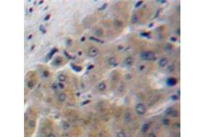 IHC-P analysis of Liver tissue, with DAB staining. (Apolipoprotein F Antikörper  (AA 122-307))