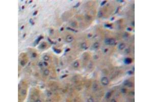 IHC-P analysis of Liver tissue, with DAB staining. (Apolipoprotein F Antikörper  (AA 122-307))