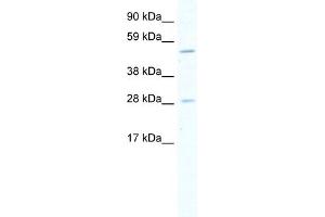 WB Suggested Anti-ASCL2 Antibody Titration:  5. (ASCL2 Antikörper  (Middle Region))