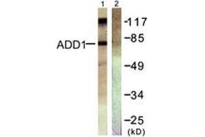 Western blot analysis of extracts from HeLa cells, treated with Forskolin 40nM 30', using ADD1 (Ab-726) Antibody.