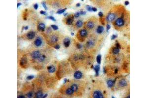 IHC-P analysis of Liver tissue, with DAB staining. (ADAMTS7 Antikörper  (AA 1589-1686))