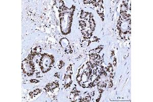 IHC analysis of CTBP2 using anti-CTBP2 antibody (ABIN7601326). (CTBP2 Antikörper  (AA 321-445))