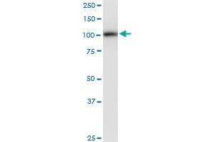 PLD2 monoclonal antibody (M01), clone 1C5. (Phospholipase D2 Antikörper  (AA 834-933))