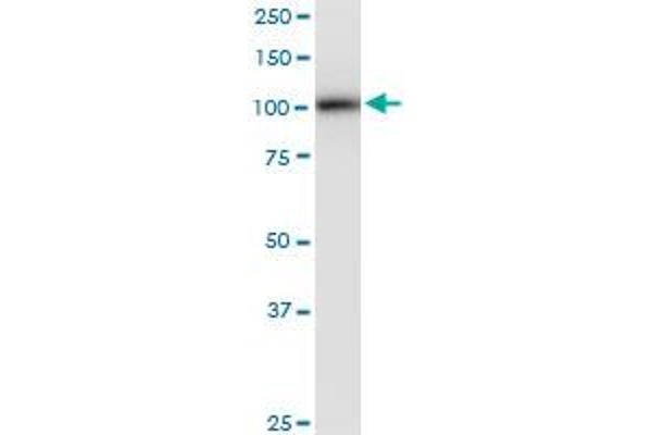 Phospholipase D2 Antikörper  (AA 834-933)