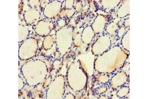 Immunohistochemistry of paraffin-embedded human thyroid tissue using ABIN7174476 at dilution of 1:100 (UBE2Q2 Antikörper  (AA 1-375))
