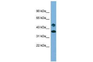 WB Suggested Anti-SETD6 Antibody Titration:  0. (SETD6 Antikörper  (Middle Region))