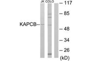 Western Blotting (WB) image for anti-Protein Kinase, CAMP Dependent, Catalytic, beta (PRKACB) (AA 291-340) antibody (ABIN2889425)