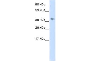 Western Blotting (WB) image for anti-Male-Specific Lethal 3 Homolog (MSL3) antibody (ABIN2461970)