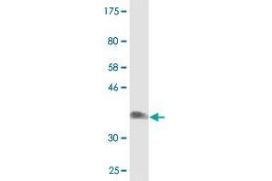 Western Blot detection against Immunogen (36. (NDST3 Antikörper  (AA 162-259))