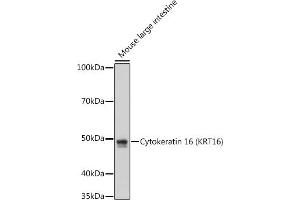 Western blot analysis of extracts of Mouse large intestine cells, using Cytokeratin 16 (KRT16) antibody (ABIN7268094) at 1:1000 dilution. (KRT16 Antikörper)