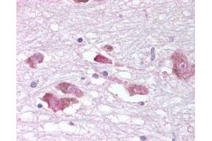 Immunohistochemical (Formalin/PFA-fixed paraffin-embedded sections) staining of human substantia nigra in brain. (MCHR1 Antikörper)
