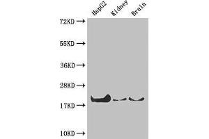 Western Blot Positive WB detected in: HepG2 whole cell lysate, Mouse kidney tissue, Mouse brain tissue All lanes: PPIA antibody at 4 μg/mL Secondary Goat polyclonal to rabbit IgG at 1/50000 dilution Predicted band size: 19, 12 kDa Observed band size: 19 kDa (PPIA Antikörper  (AA 1-165))
