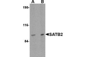 Western Blotting (WB) image for anti-SATB Homeobox 2 (SATB2) (N-Term) antibody (ABIN1031555) (SATB2 Antikörper  (N-Term))
