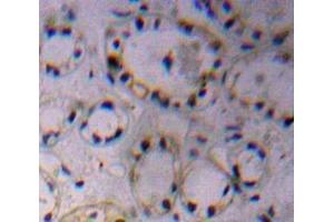 Immunohistochemistry (IHC) image for anti-ADAM Metallopeptidase Domain 17 (ADAM17) (AA 226-473) antibody (ABIN7433780)