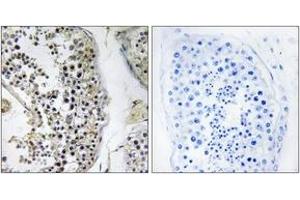 Immunohistochemistry analysis of paraffin-embedded human testis tissue, using CEP170 Antibody. (CEP170 Antikörper  (AA 701-750))
