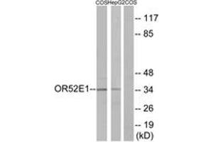 Western blot analysis of extracts from COS7/HepG2 cells, using OR52E1 Antibody. (OR52E1 Antikörper  (AA 201-250))