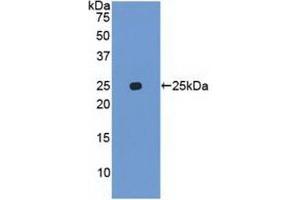 Detection of Recombinant UBD, Human using Polyclonal Antibody to Ubiquitin D (UBD) (UBD Antikörper  (AA 1-165))