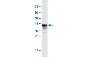 Western Blot detection against Immunogen (37. (MYT1L Antikörper  (AA 301-410))