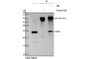 anti-Ubiquitin-Conjugating Enzyme E2K (UBE2K) (AA 33-195) antibody