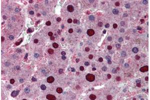 Immunohistochemistry (Formalin-fixed Paraffin-embedded Sections) (IHC (fp)) image for anti-Acidic (Leucine-Rich) Nuclear phosphoprotein 32 Family, Member A (ANP32A) (AA 1-250) antibody (ABIN790612)