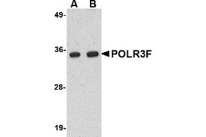 Western Blotting (WB) image for anti-Polymerase (RNA) III (DNA Directed) Polypeptide F, 39 KDa (POLR3F) (N-Term) antibody (ABIN1031522)