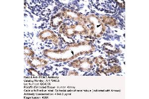 Human kidney (TRIM3 Antikörper  (N-Term))