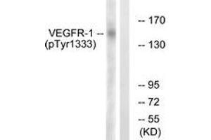 Western blot analysis of extracts from K562 cells treated with etoposide 25uM 24h, using VEGFR1 (Phospho-Tyr1333) Antibody. (FLT1 Antikörper  (pTyr1333))