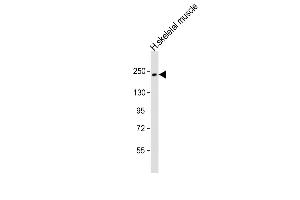 Anti-MYH7 Antibody (N-term) at 1:1000 dilution + human skeletal muscle lysate Lysates/proteins at 20 μg per lane. (MYH7 Antikörper  (N-Term))
