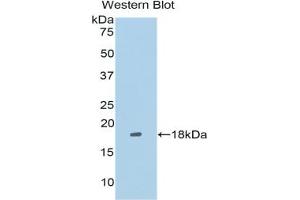 Western blot analysis of the recombinant protein. (LRRFIP1 Antikörper  (AA 128-250))