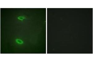 Immunofluorescence analysis of HeLa cells, using DLGP1 Antibody. (DLGAP1 Antikörper  (AA 791-840))