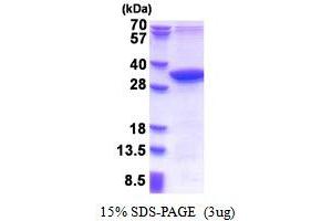 SDS-PAGE (SDS) image for Methylmalonic Aciduria (Cobalamin Deficiency) CblD Type, with Homocystinuria (MMADHC) (AA 39-296) protein (His tag) (ABIN5853506)