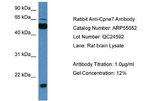 WB Suggested Anti-Cpne7  Antibody Titration: 0. (CPNE7 Antikörper  (C-Term))