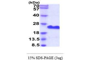 SDS-PAGE (SDS) image for Membrane-Spanning 4-Domains, Subfamily A, Member 1 (MS4A1) (AA 210-297) protein (His tag) (ABIN6388166) (CD20 Protein (AA 210-297) (His tag))